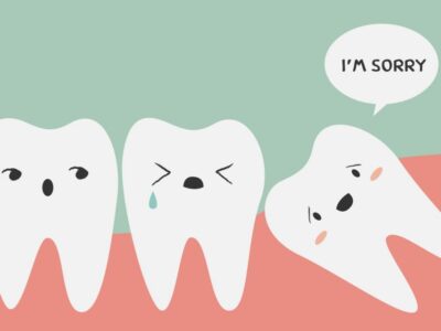 Denti del giudizio 4 dental
